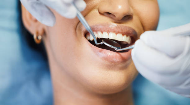 Best Emergency Dental Extractions in Val Verde, CA